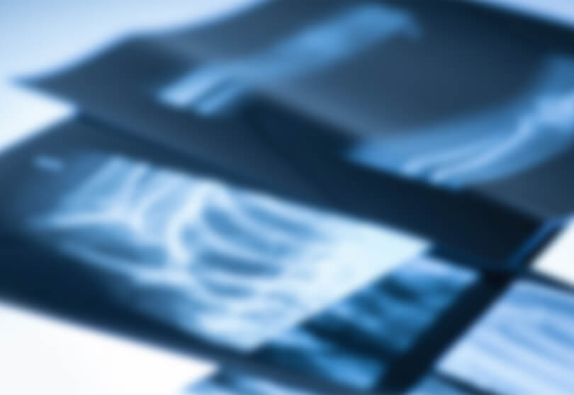 レントゲンイメージ